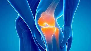 артроз колінного суглоба